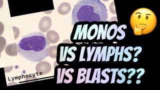 How I distinguish between Lymphocytes vs Monocytes [upl. by Merell]