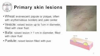 4 Primary and Secondary skin lesions [upl. by Chew]