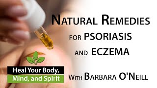 Home Remedies for Eczema and Psoriasis  Barbara ONeill 0713 [upl. by Nahtonoj685]