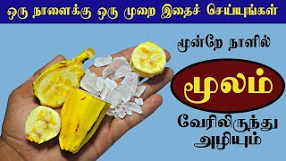 இது பைல்ஸ் என்னும் மூல நோயை வேரோடு அறுக்கும்  piles home remedy tamil [upl. by Byers667]