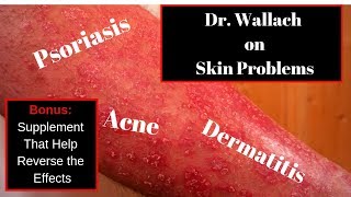 Dr Wallach on Skin Rashes [upl. by Nadnal]