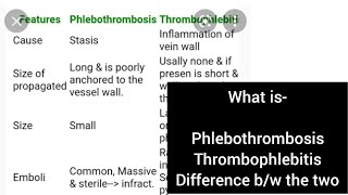 Phlebothrombosis Thrombophlebitis Pathology Second year mbbs [upl. by Zachary696]