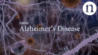 Inside Alzheimer’s disease [upl. by Popper]