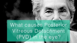 What causes Posterior Vitreous Detachment PVD in the eye [upl. by Marasco]