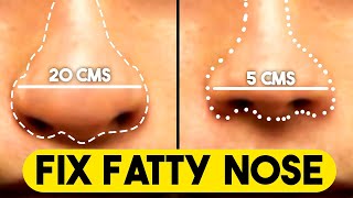 How to get slim and sharp nose  reduce nose fat howtoreducenosefat reducenosefat [upl. by Ludwigg]