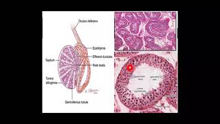 TESTICULAR TUMORS Brief introduction for medical UGsROBBINS [upl. by Irra]