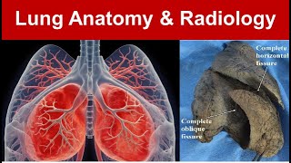 Lung Anatomy amp Radiology Gross Features Surfaces Borders and Azygous Lobe Part 1 TaimTalksMed [upl. by Weylin]