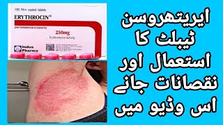 Erythrocin Tablet Uses  Erythrocin Tablet Side Effects in UrduHindi  Hafiz Murtaza [upl. by Tteirrah]