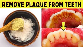 You Must Try This To Get Rid Of Plaque On Teeth Naturally At Home Without Seeing A Dentist [upl. by Sweyn667]