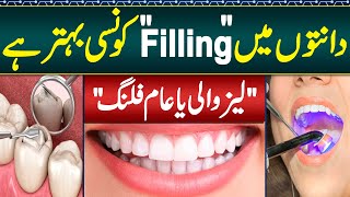 Danto Ki Filling  Best Procedure For Teeth Filling Amalgam or Composite  Types of Dental Fillings [upl. by Adiaj]