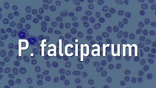 Plasmodium falciparum [upl. by Maggio]