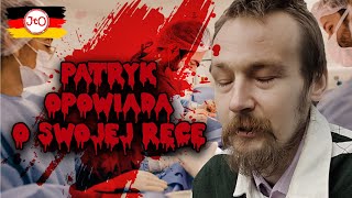 Patryk opowiada o swojej RĘCE Moje życie moja sprawa [upl. by Waine]