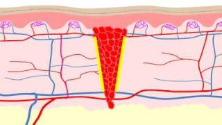 Wound Healing [upl. by Eissirk]