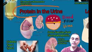 Urinalysis blood in the urine proteins in the urine ketones in the urine leukocyturia [upl. by Irrek704]