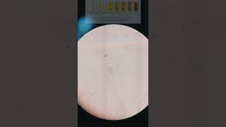 🎥Trichomoniasis Trichomonas in urine under 🎥📲Microscope Its Symptoms and sign With treatment [upl. by Antebi563]