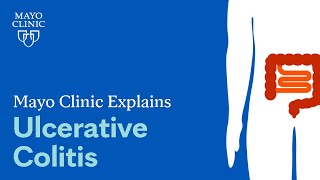 Mayo Clinic Explains Ulcerative Colitis [upl. by Llehsal]