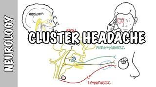 Cluster Headaches  symptoms pathophysiology treatment [upl. by Terrell]