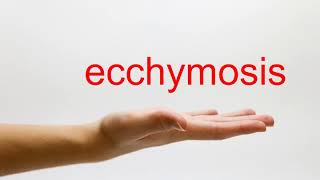 How to Pronounce ecchymosis  American English [upl. by Yenreit]