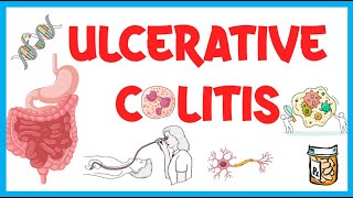 Ulcerative Colitis Causes Risk Factors Pathogenesis Clinical Presentation Diagnosis amp Treatment [upl. by Durrell32]