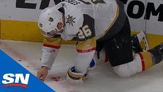 Paul Stastny Picks His Teeth Up Off The Ice After Taking Puck To Mouth [upl. by Narak]