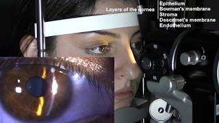 Ophthalmic Skills Series Part 15 [upl. by Horace756]