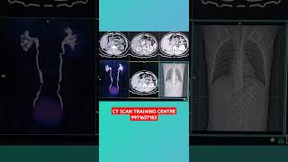 CHECK CT SCAN UROGRAPHY [upl. by Etnuad]