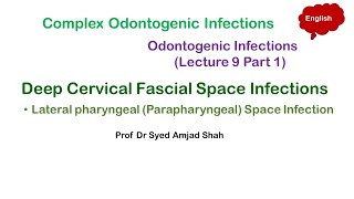 Lateral pharyngeal  Parapharyngeal Space Infection  Deep Cervical Fascial Space Infections [upl. by Akived170]