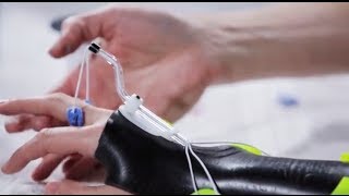 Dorsal wrist orthosis Orfilight Black with Orfitube outrigger  Splinting techniques 810 [upl. by Ellerihs]