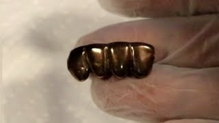 can this extreme tarnish 10k gold grill be cleaned how to stop it from getting tarnished [upl. by Comstock280]