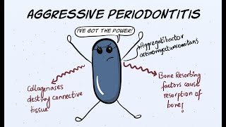 Aggressive Periodontitis Part 1  Etiology and Pathogenesis [upl. by Nyledaj]