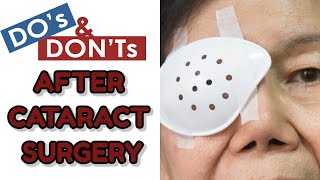 DOS AND DONTS AFTER CATARACT SURGERY EYE CARE TIPS AFTER CATARACT SURGERY [upl. by Llerrej]