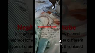 Nephrostomy tube placement kidneyrecipient kidneywarrior urineleak transplantwoes transplant [upl. by Joao736]