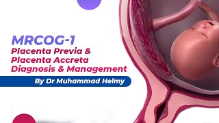 MRCOG1  Placenta Previa amp Placenta Accreta  Diagnosis amp Management  By Dr Muhammad Helmy [upl. by Akin139]