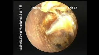 Differences in 3 types of ear conditions [upl. by Ethelind]