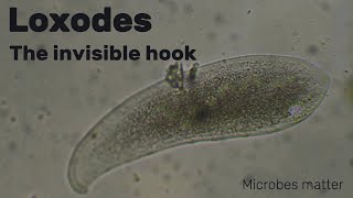 Loxodes  the micro  hooks of the unseen world  under the microscope [upl. by Teece]