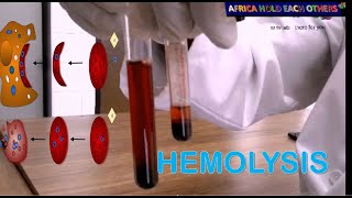 What is hemolysis  what are the causes of hemolysis Hemolysis experiment in vitro [upl. by Perzan]