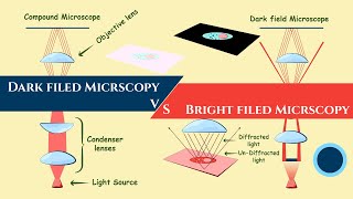 dark filed and bright field microscopy  compound microscope vs dark field microscope hindi\Urdu [upl. by Eirellam]