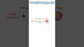 SYSTEMIC LUPUS ERYTHEMATOSUS  Pathophysiology [upl. by Limoli]