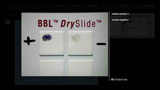 Oxidase Test DrySlide  Microbiology [upl. by Aspa400]