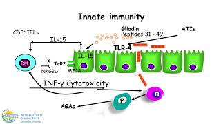 NonCeliac Gluten Sensitivity [upl. by Cacia]