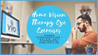 6 Home Vision Therapy Eye Exercises to Strengthen Your Vision  Lazy Eye  Mirror Superimposition [upl. by Wina971]