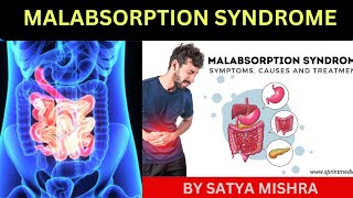 Malabsorption Syndrome  child health Nursing Online Nursing Classes  Easy Explanation in Hindi [upl. by Nitreb999]