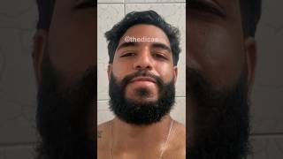 10 MESES usando MINOXIDIL antes e depois  Evolução minoxidil minoxidil barba thedicas [upl. by Leandro]