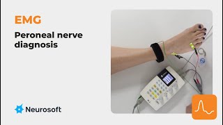 EMG the peroneal nerve diagnosis [upl. by Atsirc]