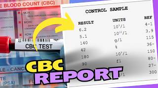 CBC Blood Test Results How to Read and Understand Your Results [upl. by Maker]