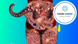 ASMR Animation Treatment Infected Mans Stomach amp Severely Losing Leg Treatment  asmr [upl. by Edmonda]