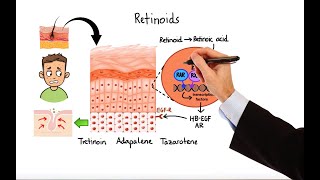 Pharmacology  ACNE TREATMENTS MADE EASY [upl. by Ajidahk7]